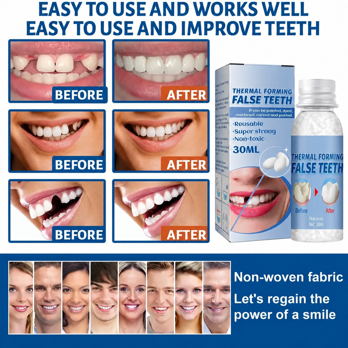 Hot melt adhesive denture beads for temporary restoration of missing or broken teeth | Filling alternatives