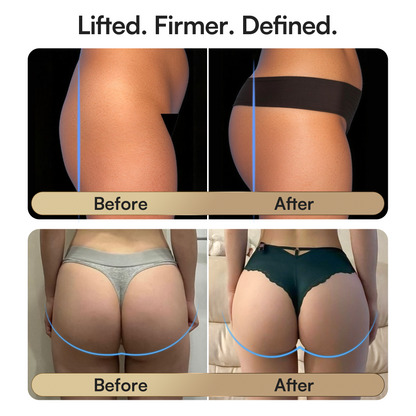 Booty Lift Shorts - Multi-Mode EMS Microcurren