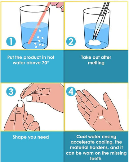 Hot melt adhesive denture beads for temporary restoration of missing or broken teeth | Filling alternatives
