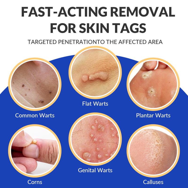 ✨Salicylic Acid 20% Wart Remover Gel, Common & Plantar Wart Treatment, Fast-Drying Formula for External Use, 0.5 Oz (15g)