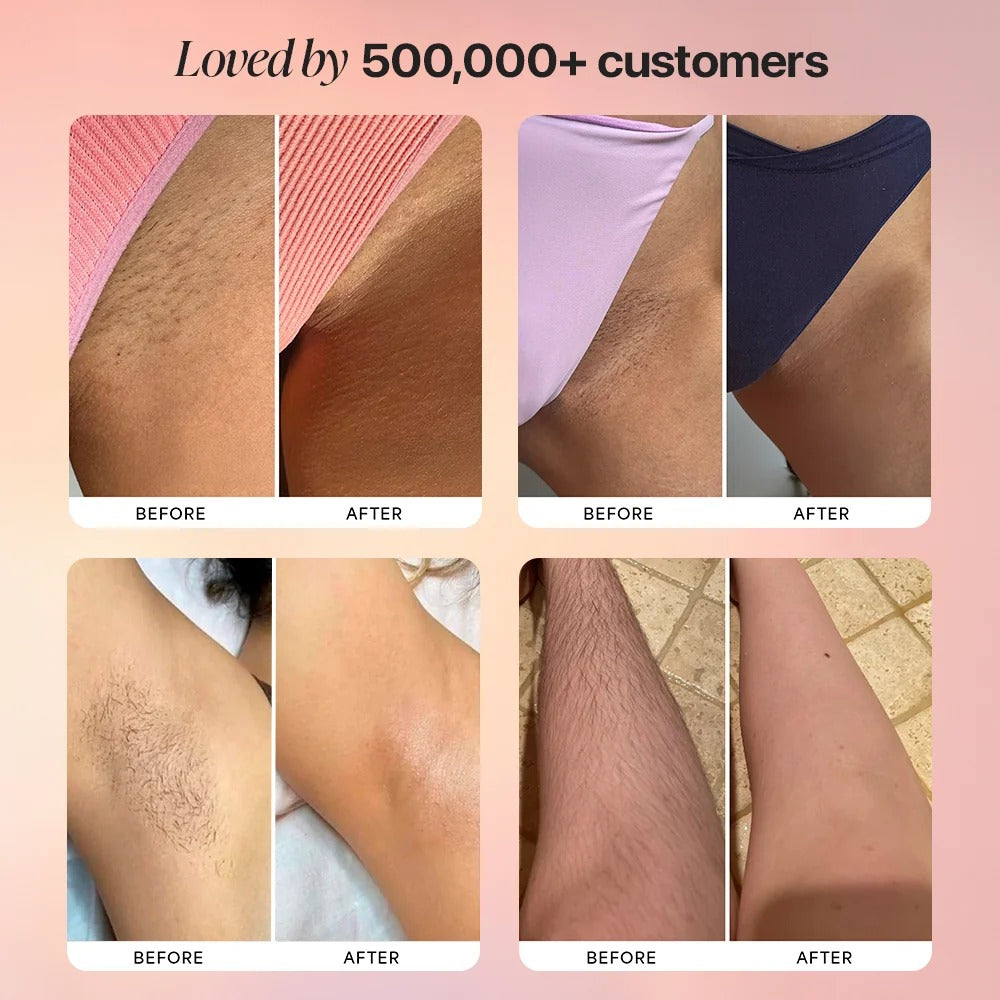 Bikini Trimmer for Women