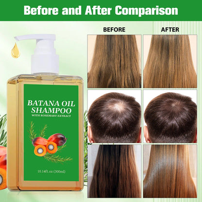 🔥50% OFF TODAY🌿Hair Growth & Strengthening Shampoo